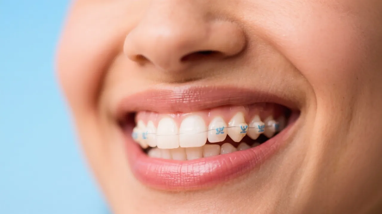 Discover Invisalign Orthodontics Nearby